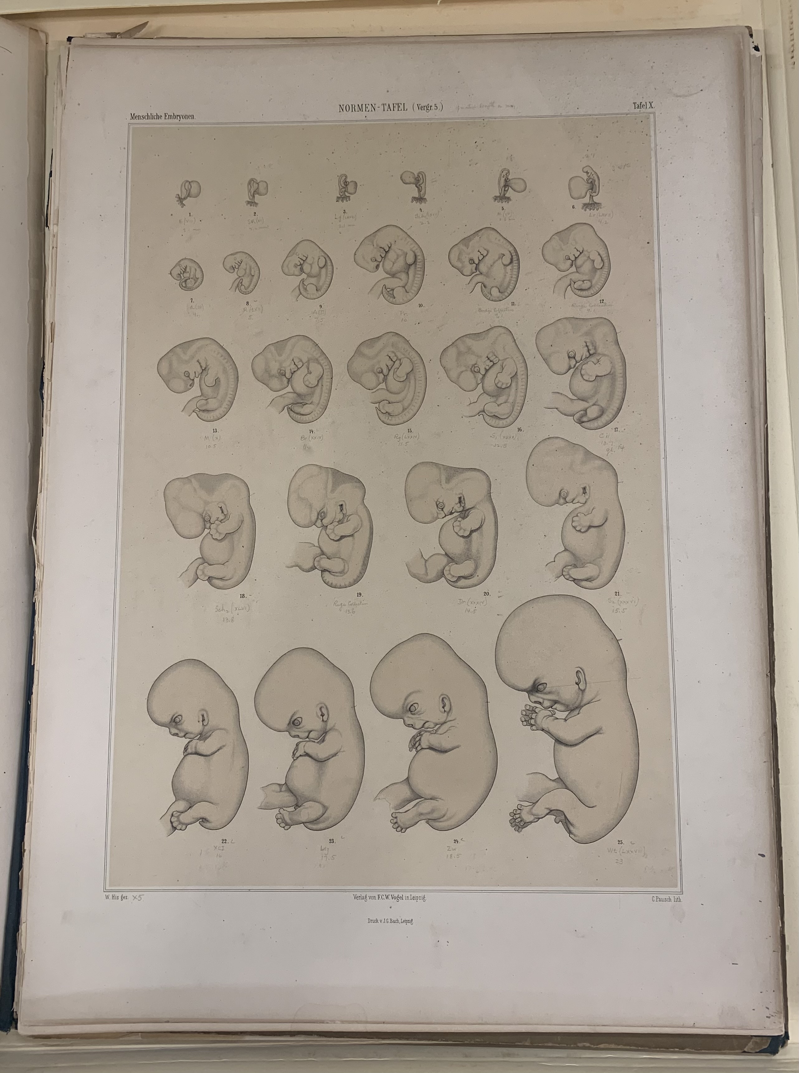 Image 3: Anatomie menschlicher Embryonen, Volume 3, Wilhelm His, 1885 APS 612.64 H62a