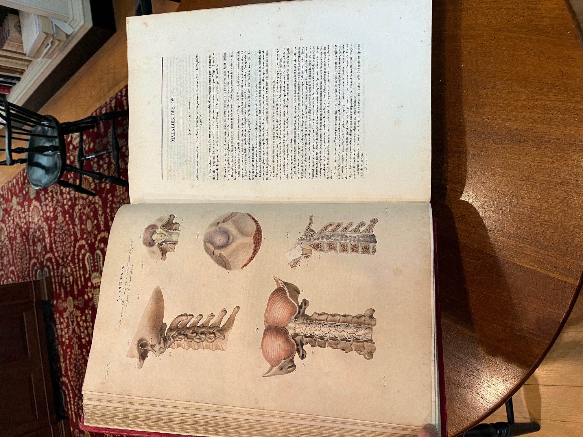 photo of open book with anatomical drawing on left and text on right