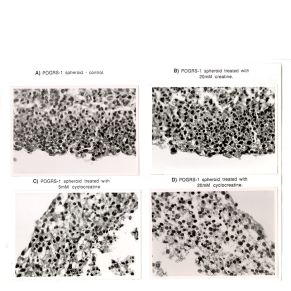 Microscope photos of POGRS-1 cells