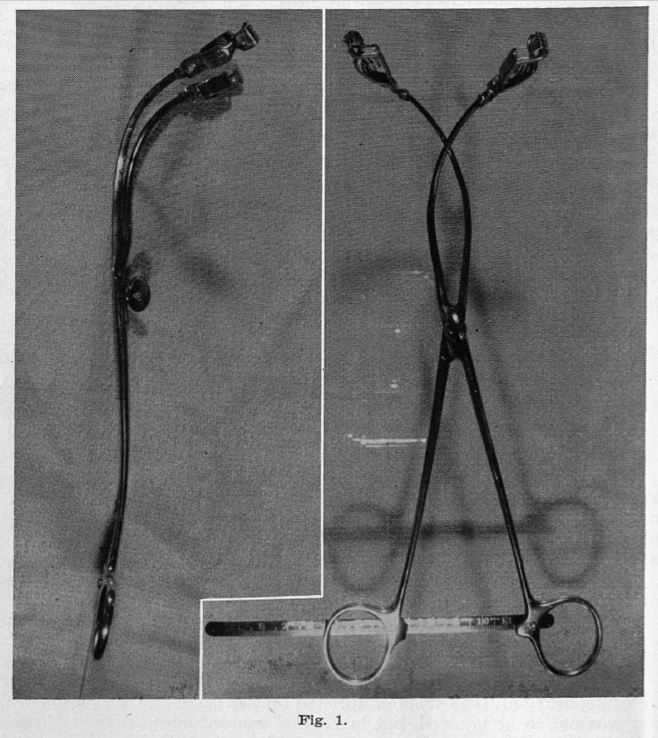 image of electronic cervimeter