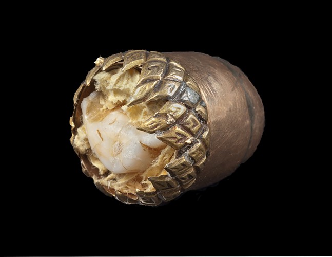 Tooth acorn