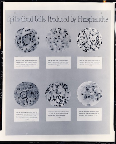 Microscope photographs of cells