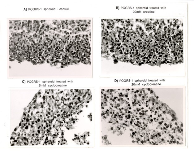 Microscope photos of POGRS-1 cells